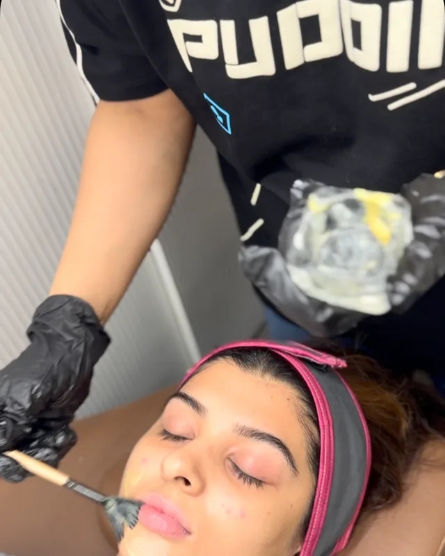 Another Peel Is Here!! 😍
